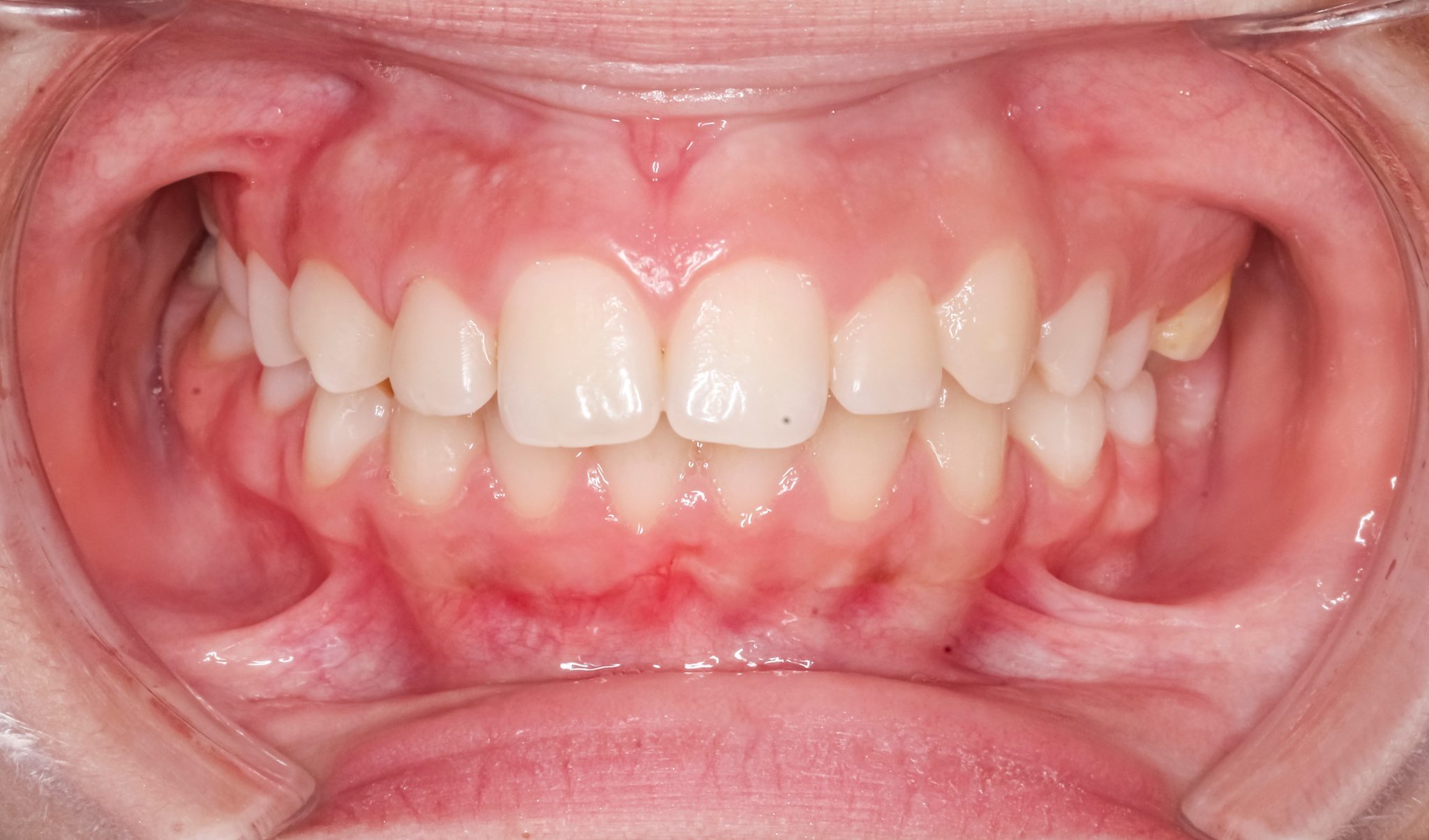 New Home Page - Jawsurgery